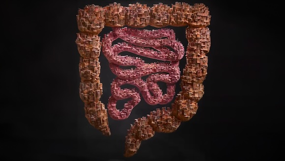 Case Study Video: Slums for Worms Case Study Video: Slums for Worms